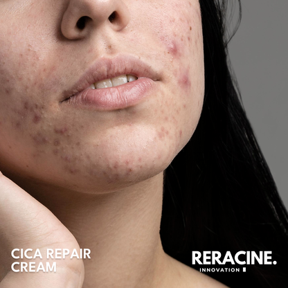 Reracine Cica Repair Cream