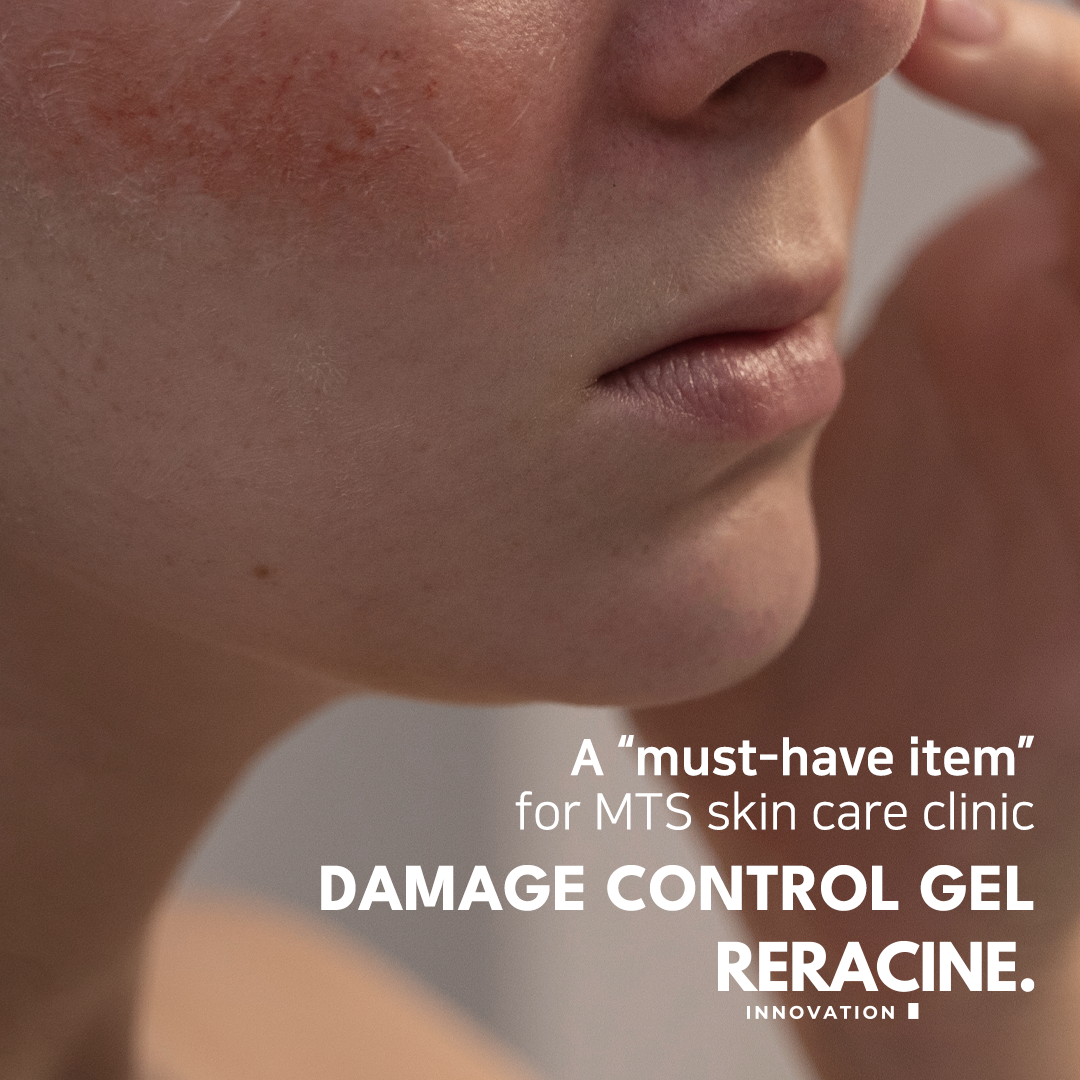 Reracine Damage Control Gel