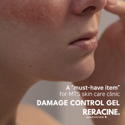 Reracine Damage Control Gel