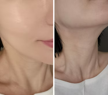 [LAVIUS] EGF Ampoule