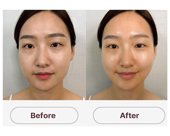 Medisco SkinGlow Mask