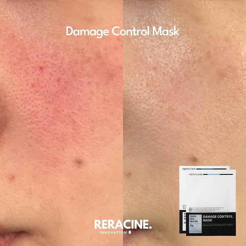 [Reracine] Damage Control Mask 30g x 5pcs