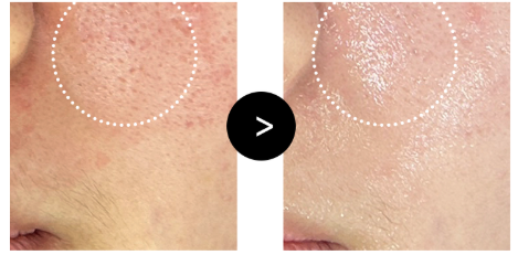 [Reracine] Recharge Booster Balm