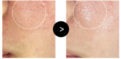 [Reracine] Recharge Booster Balm