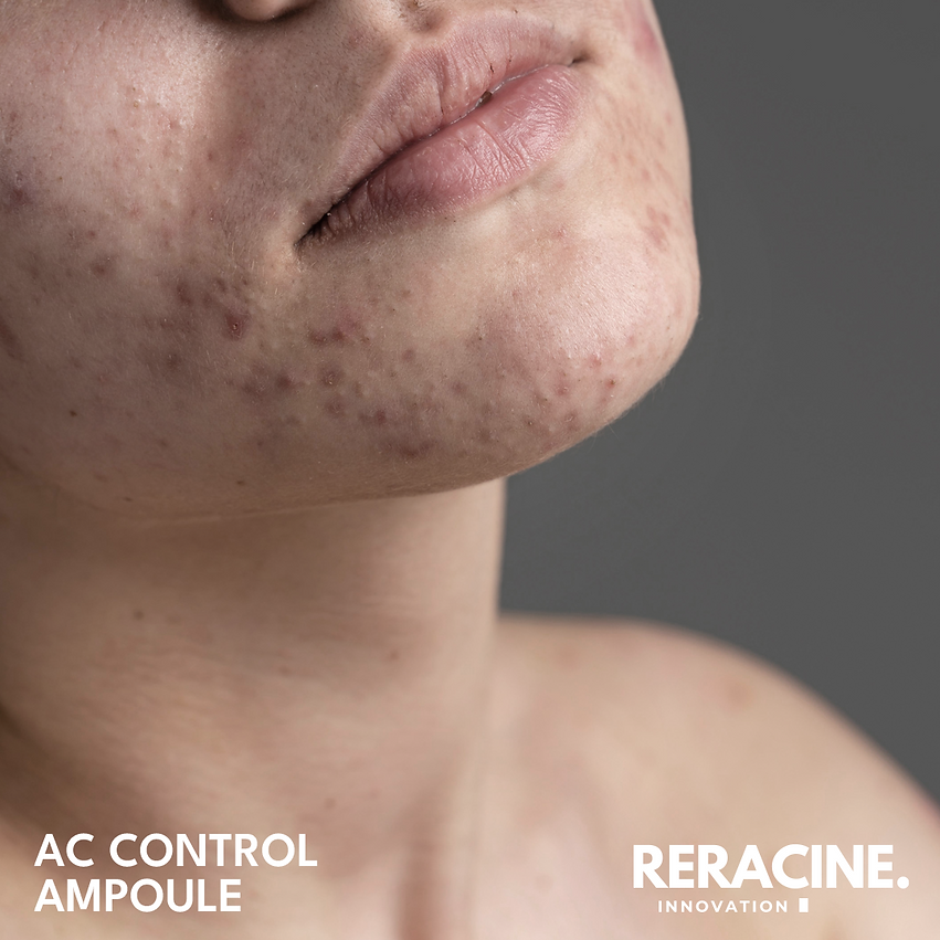 [Reracine] A.C. Control Ampoule